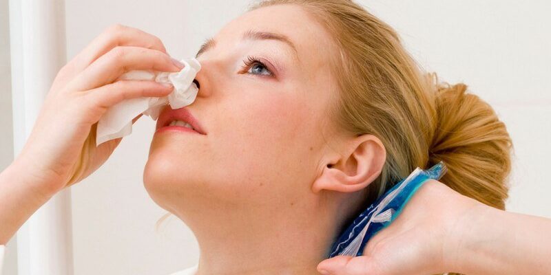 Nosebleeds – Prevention &&nbsp;Treatment