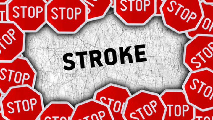 Stroke – Prevention&nbsp;Techniques