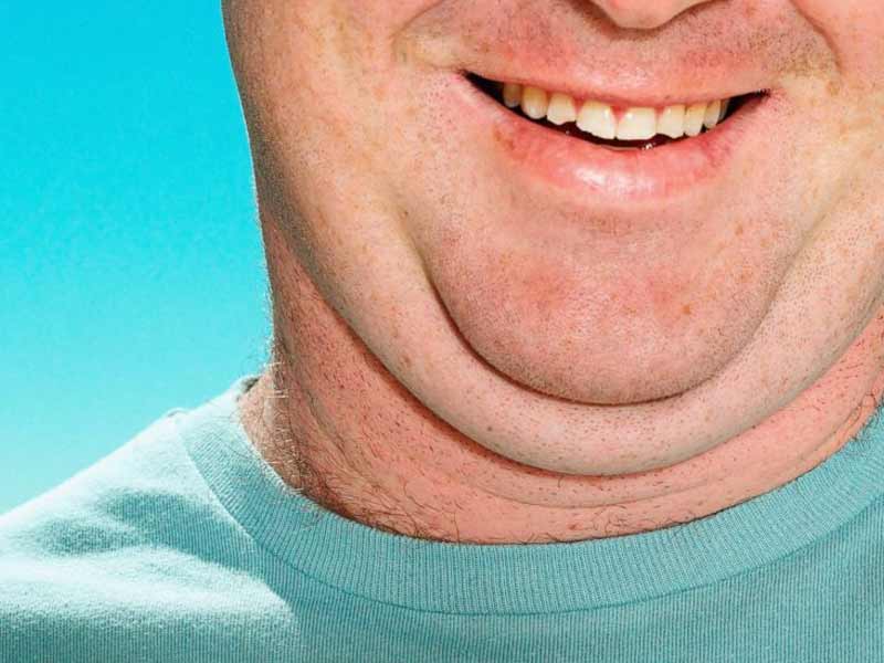 Easy Double Chin&nbsp;Exercises
