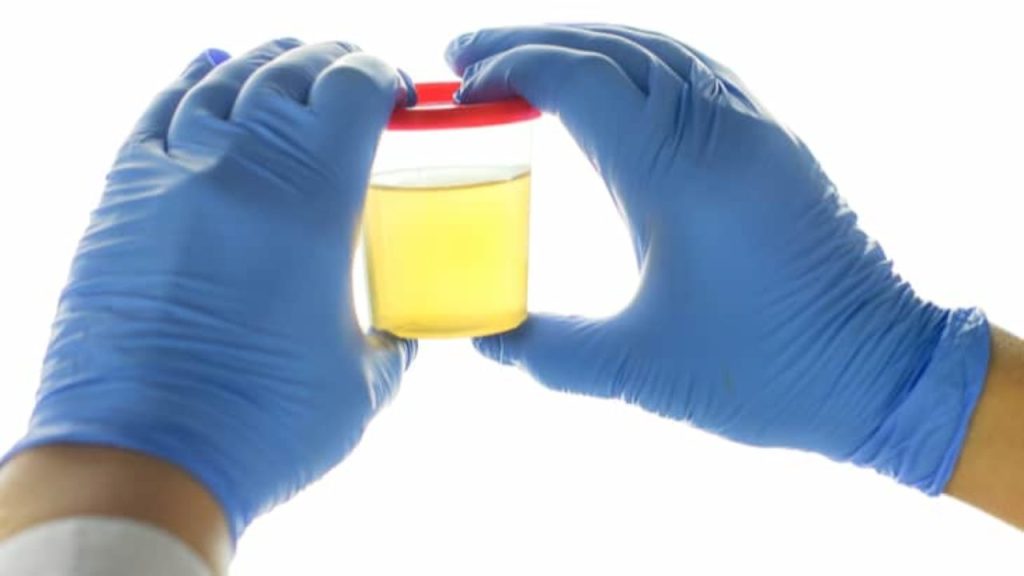 Urine Colour and&nbsp;Health