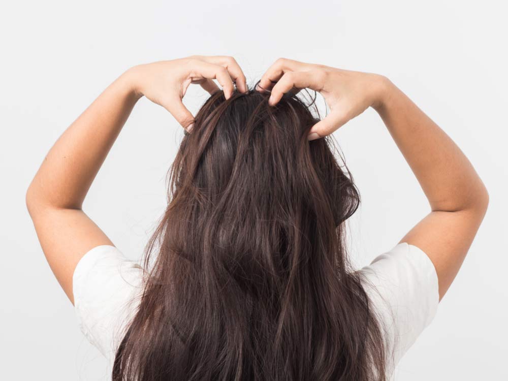 Home Remedies for&nbsp;Psoriasis